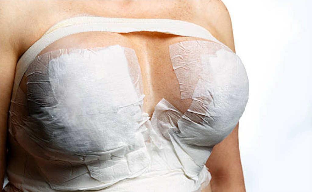Breasts Plastic Surgeries Breasts Plastic Surgeries