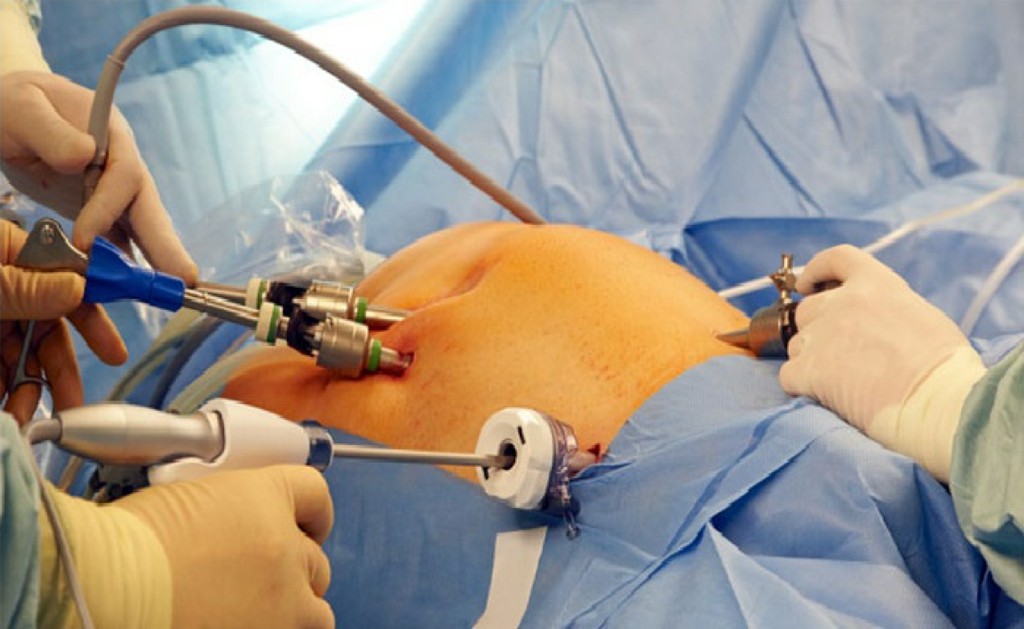 Laparoscopic Surgeon Laparoscopic Surgeon