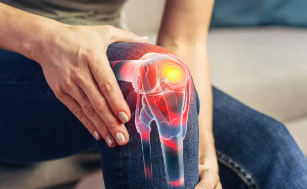 Orthopedics Orthopedics