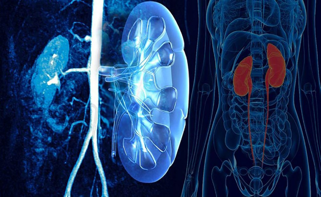Urologic Diseases Urologic Diseases