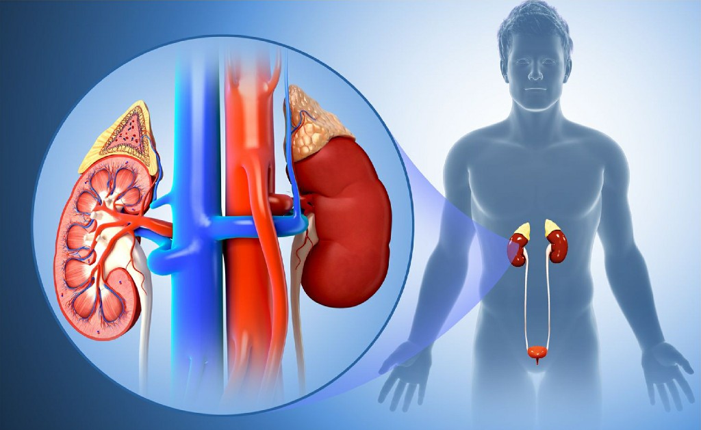 Kidney Infection Incisional Hernia