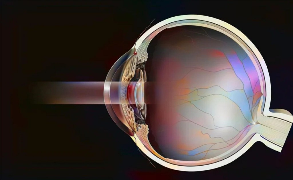 ND. Yag Laser Kulkarni Eye Hospital Ballari ND. Yag Laser Kulkarni Eye Hospital Ballari