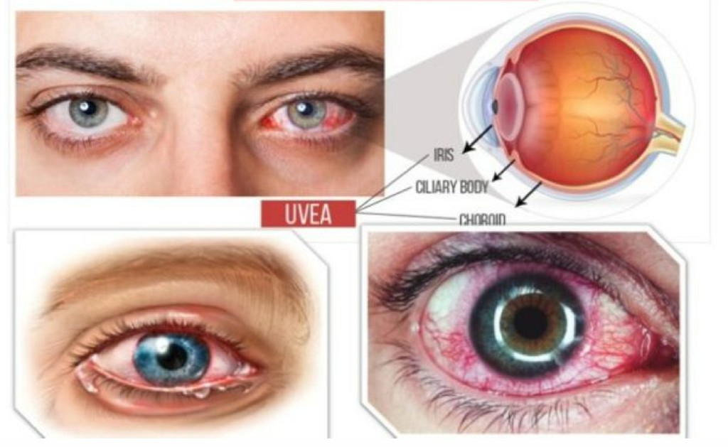 Vitreo-Retinal Centre Kulkarni Eye Hospital Ballari Vitreo-Retinal Centre Kulkarni Eye Hospital Ballari
