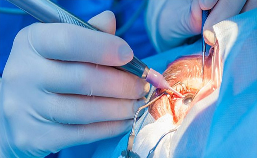 Vitreo-Retinal Surgery Kulkarni Eye Hospital Ballari Vitreo-Retinal Surgery Kulkarni Eye Hospital Ballari