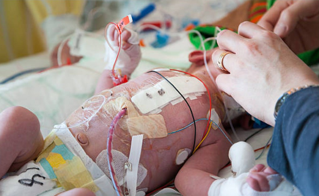 Pediatric Surgery Pediatric Surgery