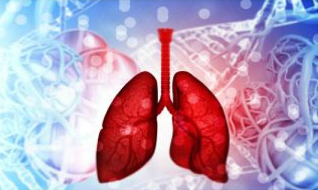 Lytic Lesions Of Lungs Lytic Lesions Of Lungs, N B Hospital Dr, Kasa Somasekhar Ballari