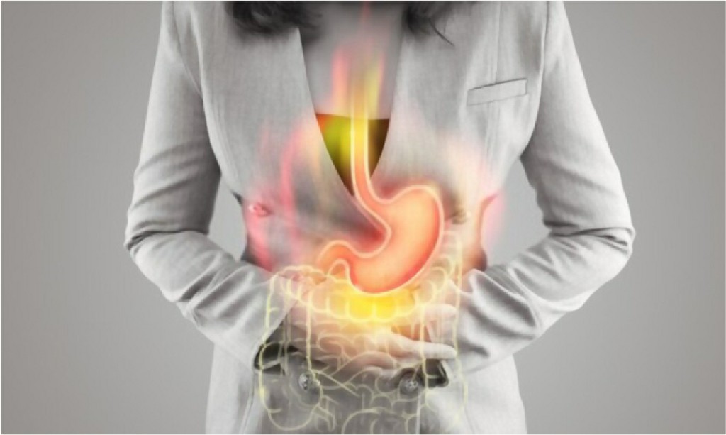 Peptic Ulcer Acidity Peptic Ulcer Acidity, N B Hospital Dr, Kasa Somasekhar Ballari