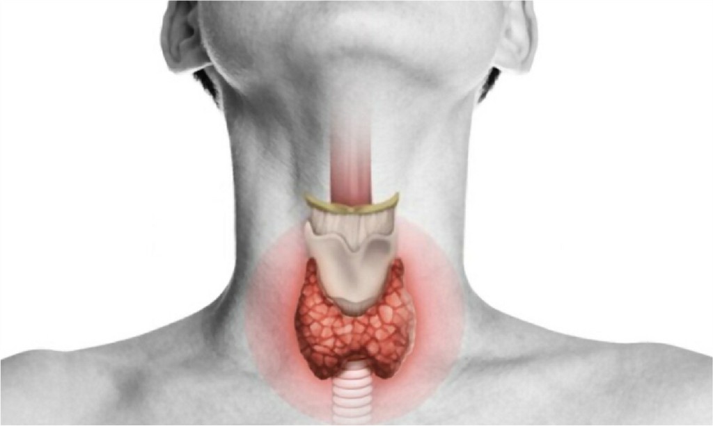 Thyroid Disease Thyroid Disease N B Hospital Dr, Kasa Somasekhar Ballari