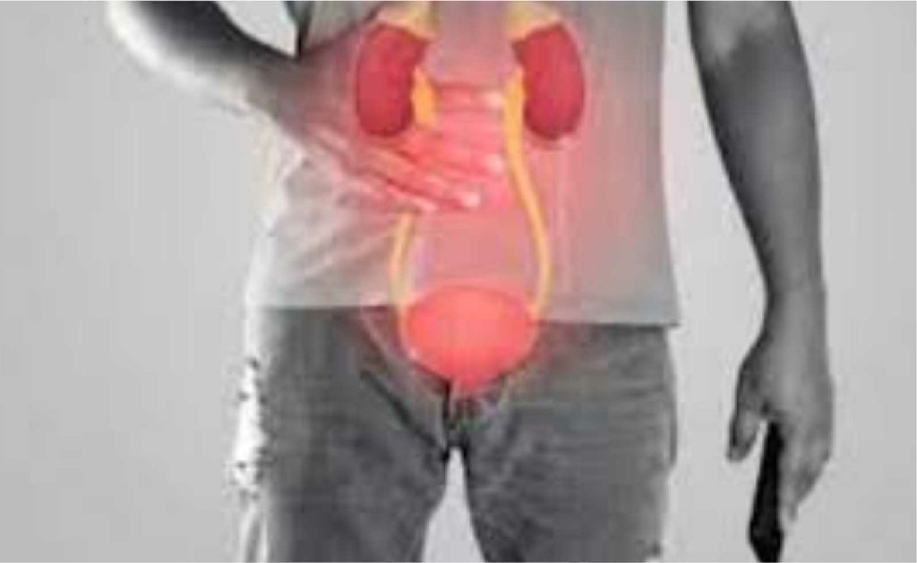 Urogenital Cancer Breast Cancer Surgery