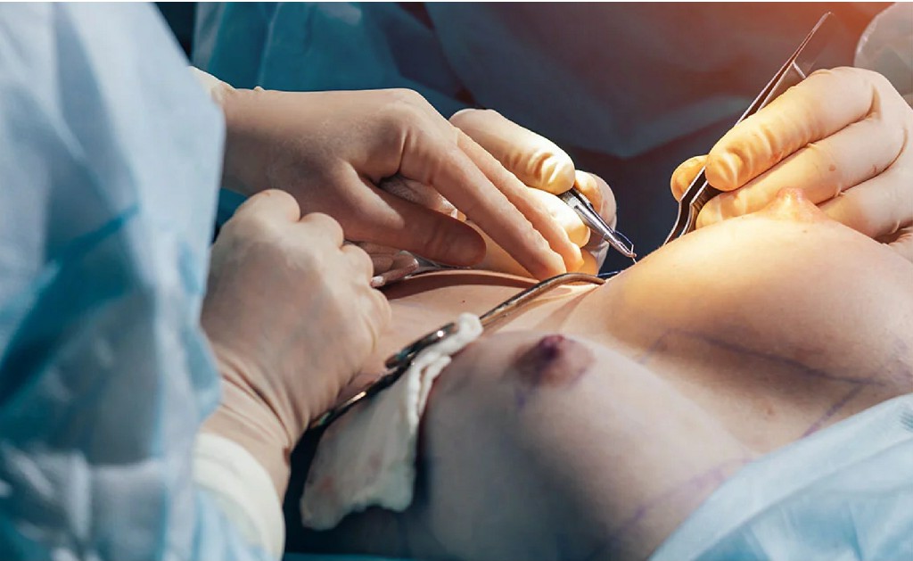 Breast Surgeries Piles In Ano