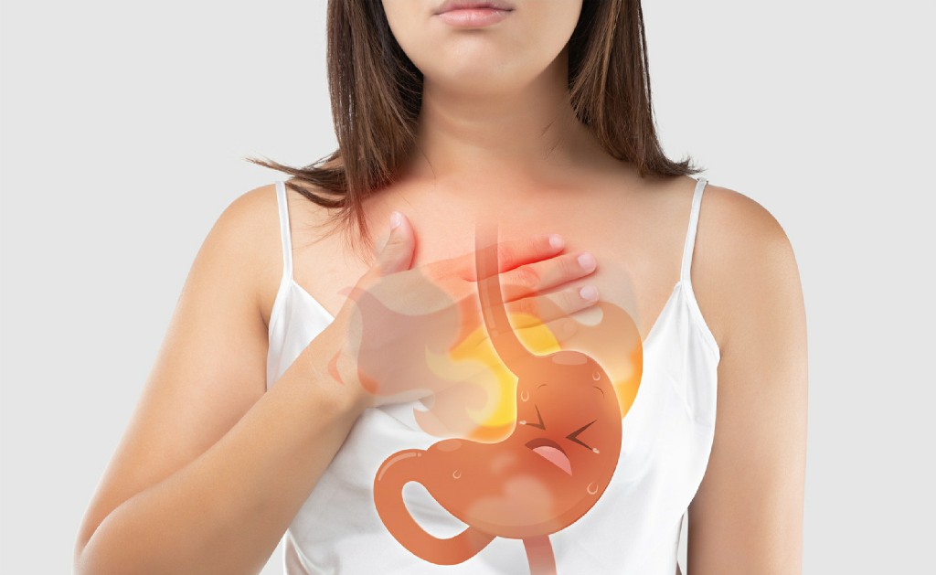 Gerd Reflux Disease Inguinal Hernia