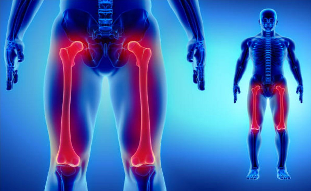 HIp Fracture Treatment HIp Fracture Treatment