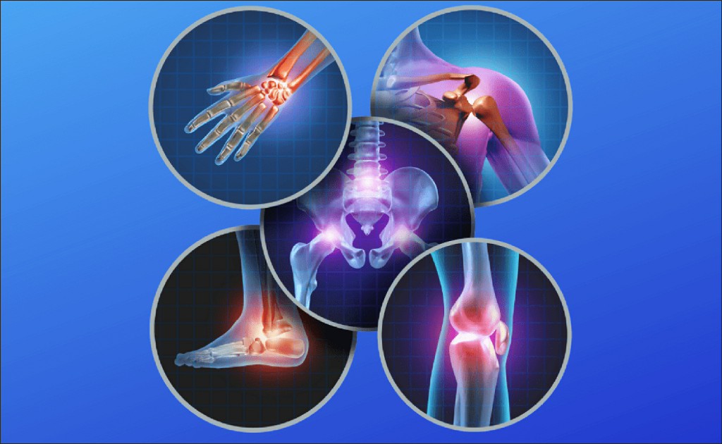 Orthopedic Orthopedic
