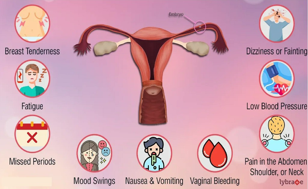 Tubal Ectopic Pregnancy Orthopedics