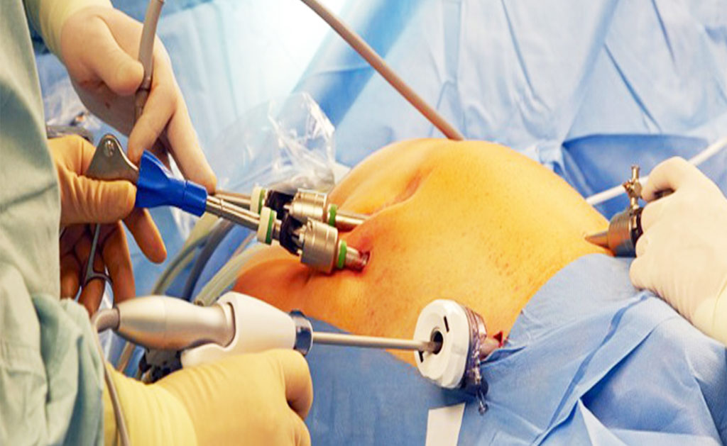 Urology-Surgery Urology Surgery