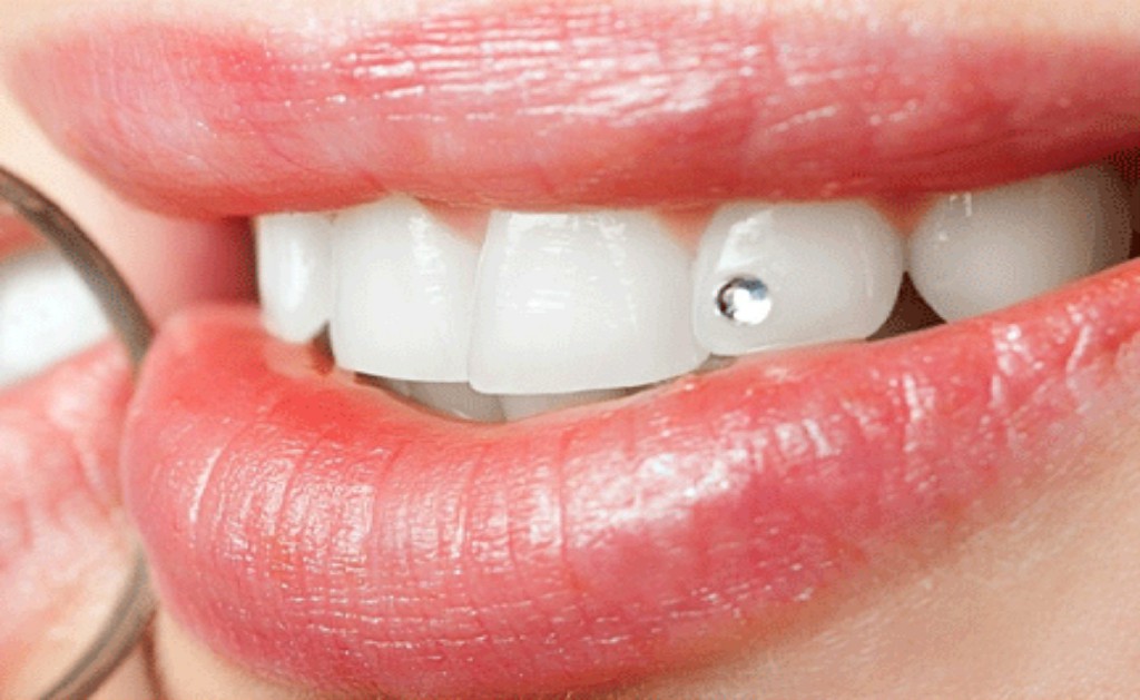 Aesthetic Dentistry