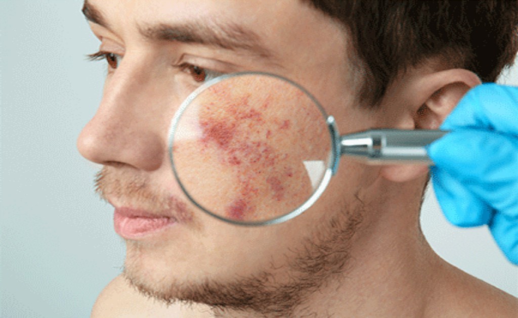 Cosmetic Dermatology