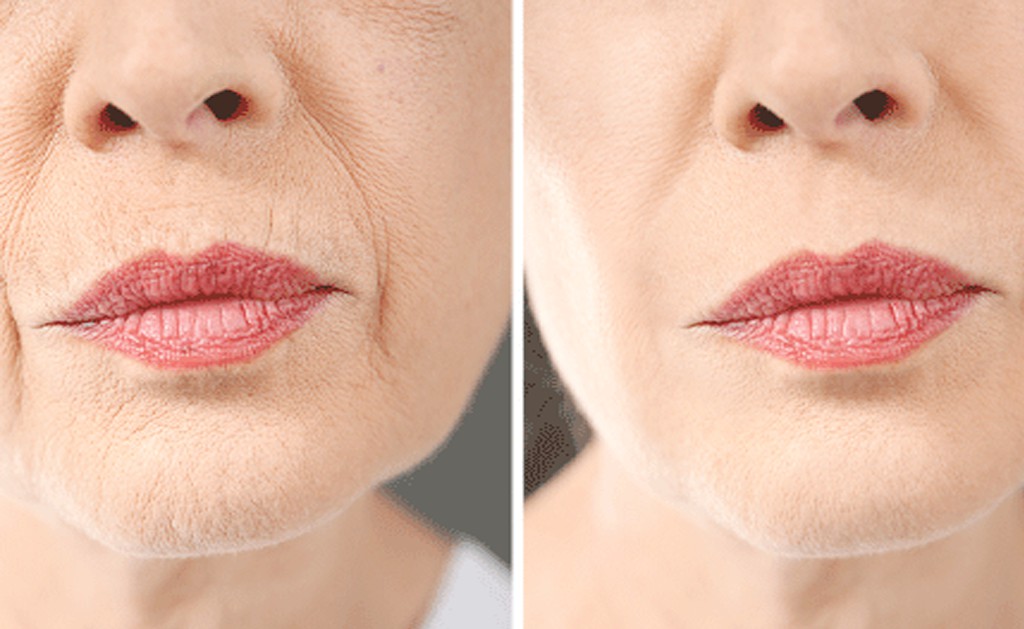 Cosmetic-Surgery