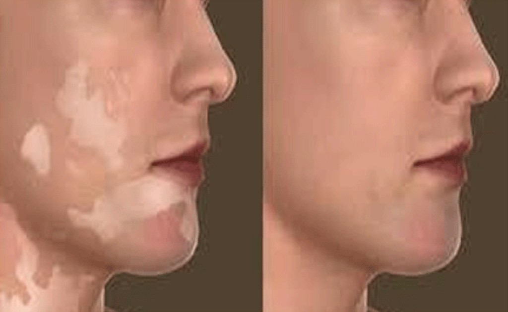 Dermatosurgery
