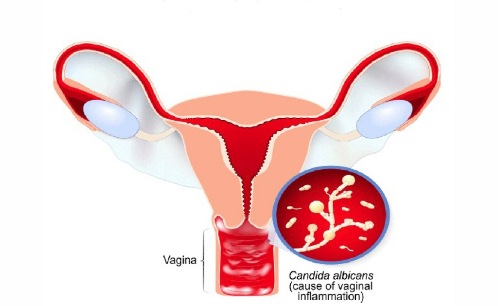 Gynaecology