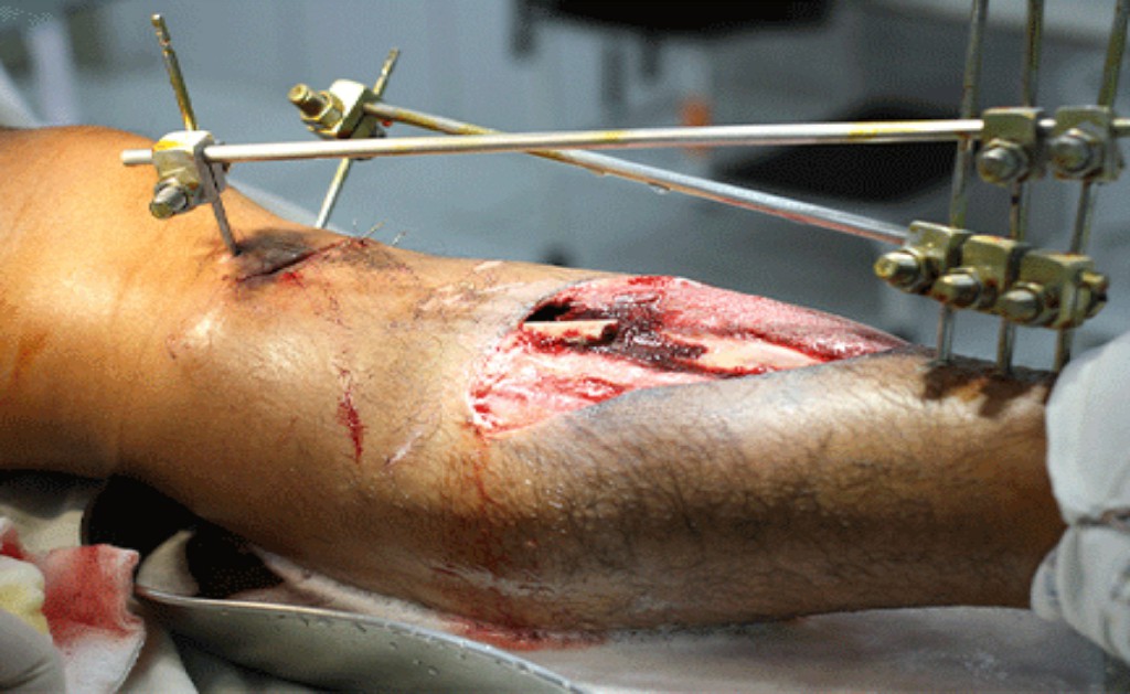 Trauma Surgery