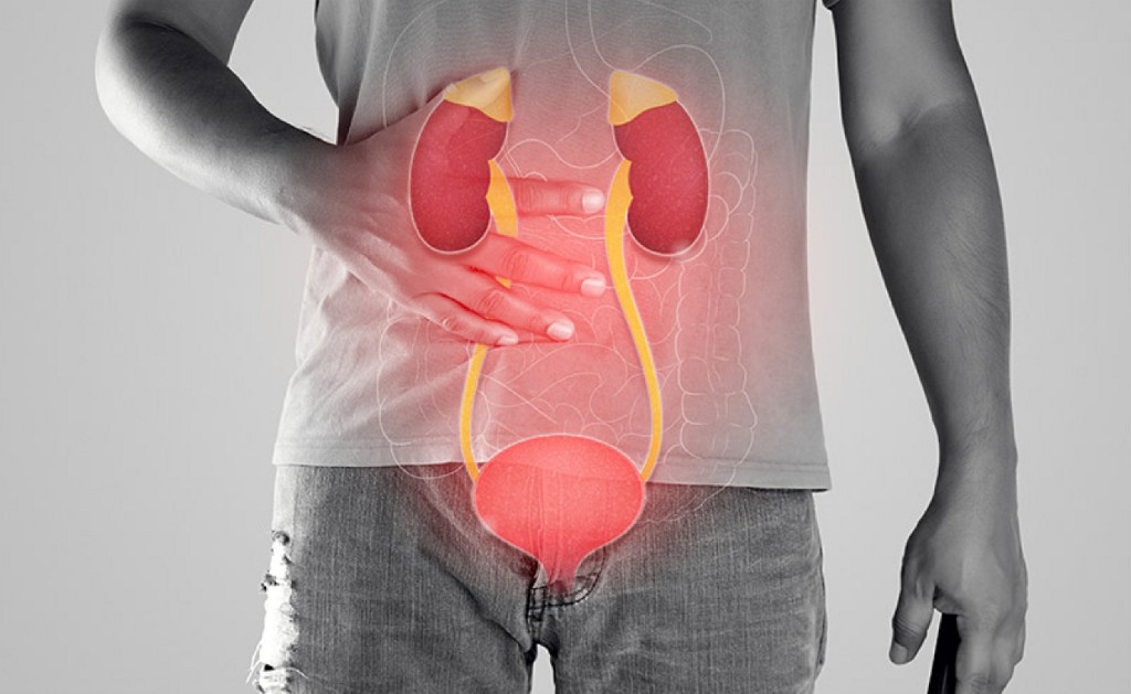 Urology Surgery Urology Surgery